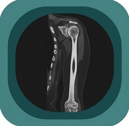 CT upper arm anatomy icon-1771230526